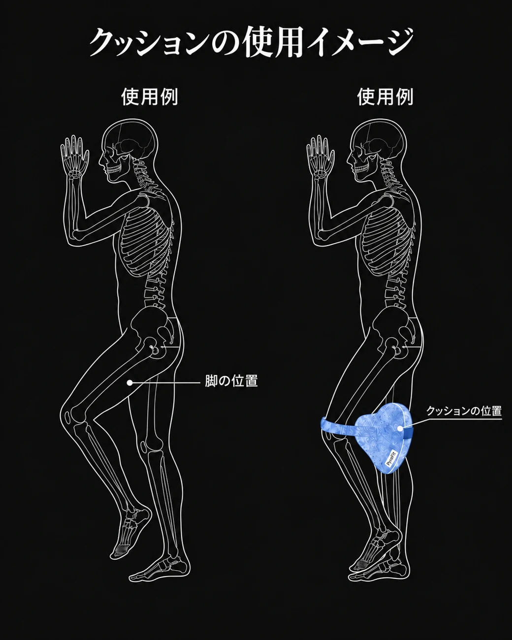 横向き寝用人間工学膝枕—ドイツ語の商品画像