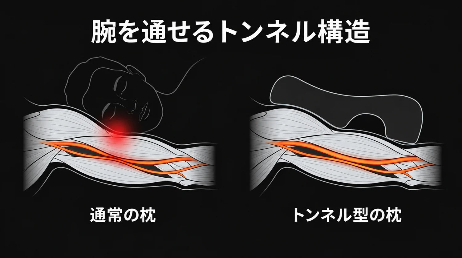 腕が圧迫される仕組みと、トンネルがそれを防ぐ方法